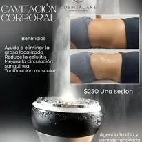 Cavitación corporal