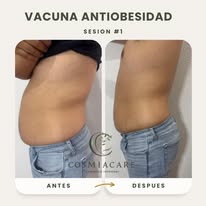 Vacuna antiobesidad antes y después